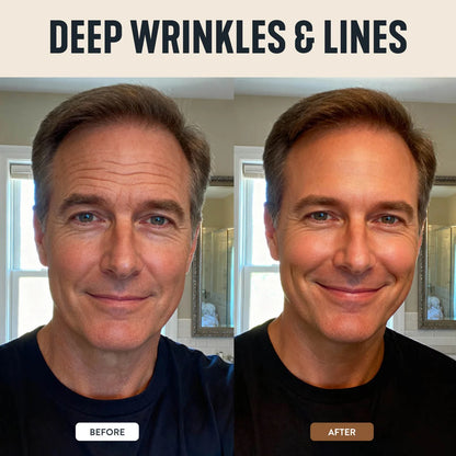Forge Wrinkle Defense Tallow balm